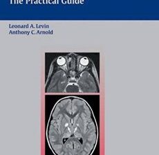 neuro ophthalmology: the practical guide