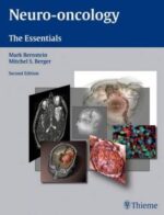 neuro oncology: the essentials, 2nd edition
