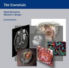 neuro oncology: the essentials, 2nd edition