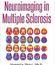 neuroimaging in multiple sclerosis