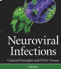 neuroviral infections: general principles and dna viruses