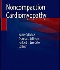 Noncompaction Cardiomyopathy