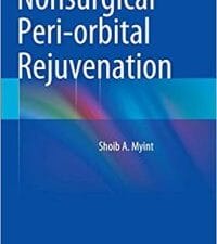 nonsurgical peri orbital rejuvenation