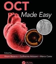 oct made easy 1st edition
