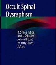 occult spinal dysraphism