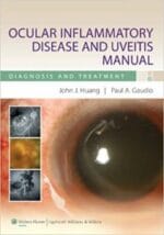 ocular inflammatory disease and uveitis manual: diagnosis and treatment