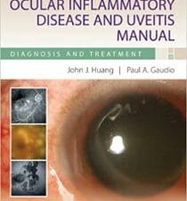 ocular inflammatory disease and uveitis manual: diagnosis and treatment