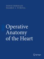 operative anatomy of the heart