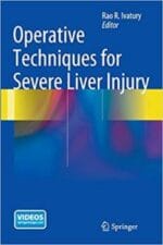 operative techniques for severe liver injury