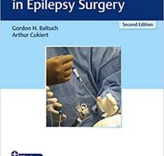 operative techniques in epilepsy surgery