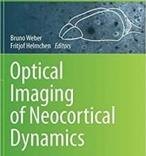 optical imaging of neocortical dynamics