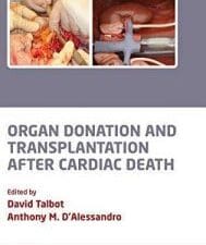 Organ donation and transplantation after cardiac death