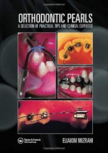 Orthodontic Pearls A Selection of Practical Tips and Clinical Expertise