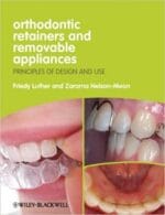 Orthodontic Retainers and Removable Appliances: Principles of Design and Use 1st Edition