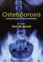 osteoporosis: diagnosis and management