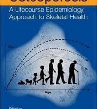 Osteoporosis: A Lifecourse Epidemiology Approach to Skeletal Health