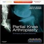 partial knee arthroplasty :techniques for optimal outcomes