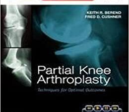 partial knee arthroplasty :techniques for optimal outcomes