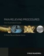 pain relieving procedures: the illustrated guide