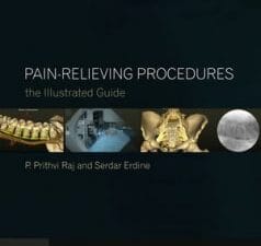 pain relieving procedures: the illustrated guide