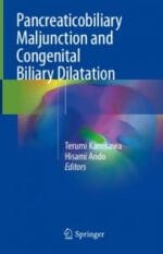 pancreaticobiliary maljunction and congenital biliary dilatation