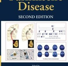 parkinson’s disease, second edition