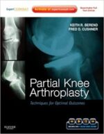 partial knee arthroplasty: techniques for optimal outcomes with dvd; expert consult – online & print 1st edition