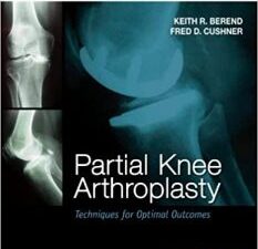 partial knee arthroplasty: techniques for optimal outcomes with dvd; expert consult – online & print 1st edition