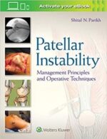 patellar instability: management principles and operative techniques 1st edition