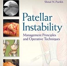 patellar instability: management principles and operative techniques 1st edition