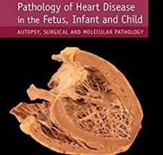 Pathology of Heart Disease in the Fetus, Infant and Child: Autopsy, Surgical and Molecular Pathology