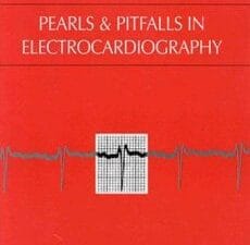 Pearls & Pitfalls in Electrocardiography : Pithy, Practical Pointers 2nd Edition
