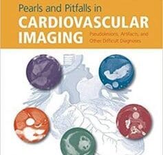 Pearls and Pitfalls in Cardiovascular Imaging: Pseudolesions, Artifacts, and Other Difficult Diagnoses