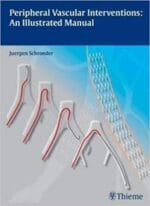 peripheral vascular interventions: an illustrated manual