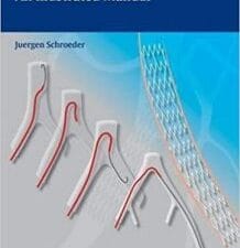 peripheral vascular interventions: an illustrated manual