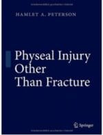 physeal injury other than fracture