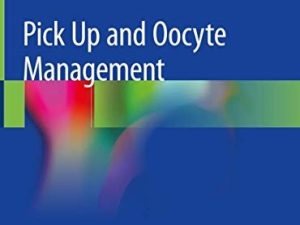 pick up and oocyte management