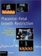 placental fetal growth restriction 1st edition