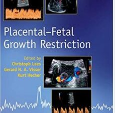 placental fetal growth restriction 1st edition