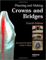 planning and making crowns and bridges 4th edition