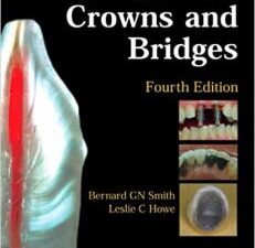 planning and making crowns and bridges 4th edition