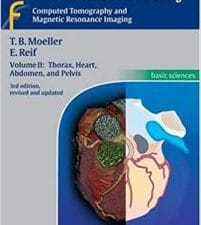 Pocket Atlas of Sectional Anatomy, Computed Tomography and Magnetic Resonance Imaging, Vol. 2: Thorax, Heart, Abdomen, and Pelvis 3rd Edition