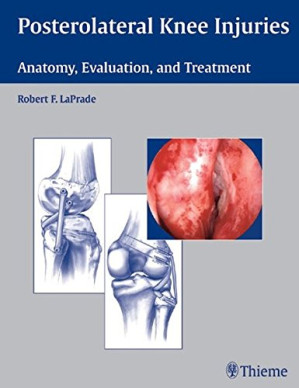 posterolateral knee injuries: anatomy, evaluation, and treatment