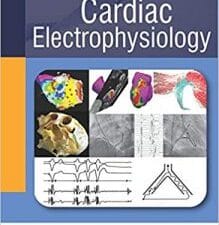 Practical Cardiac Electrophysiology