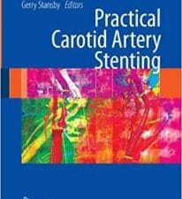 practical carotid artery stenting