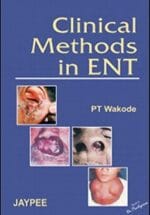 Clinical Methods in ENT