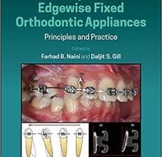 Preadjusted Edgewise Fixed Orthodontic Appliances: Principles and Practice 1st Edition