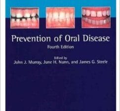 Prevention of Oral Disease, 4 edition