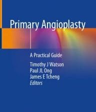 Primary Angioplasty: A Practical Guide