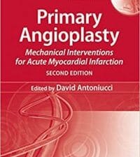 primary angioplasty: mechanical interventions for acute myocardial infarction, second edition